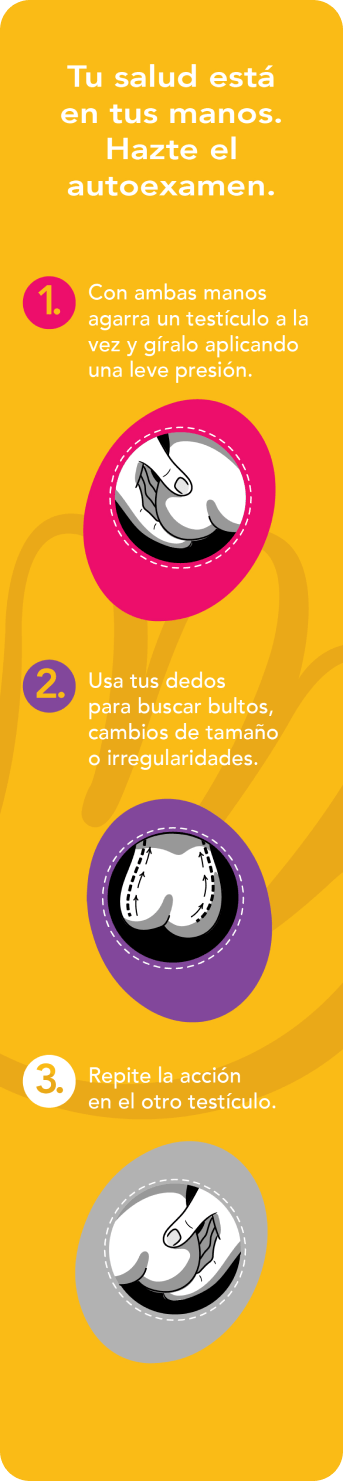 autoexamen Cancer Testícular
